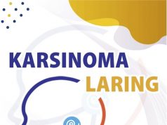 Karsinoma Laring